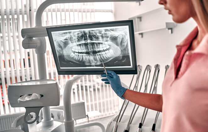 专业医生或牙医出示牙齿x光片的图像推荐患者在牙科和牙科治疗中 在工作场所工作智能专业建议