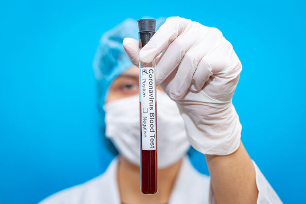 生物化学年轻的女医生戴着口罩 血液检测结果呈阳性 这是一种在全球迅速传播的新型冠状病毒诊断实验室中国