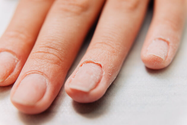 清洁美甲角质层在指甲上皮肤护理皮肤纯洁