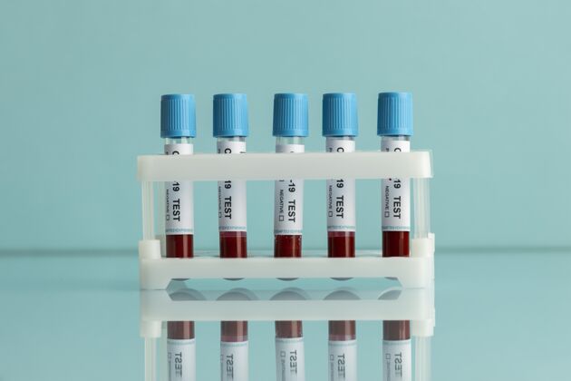 疾病实验室里做柯维德测试的血样实验室病毒冠状病毒测试