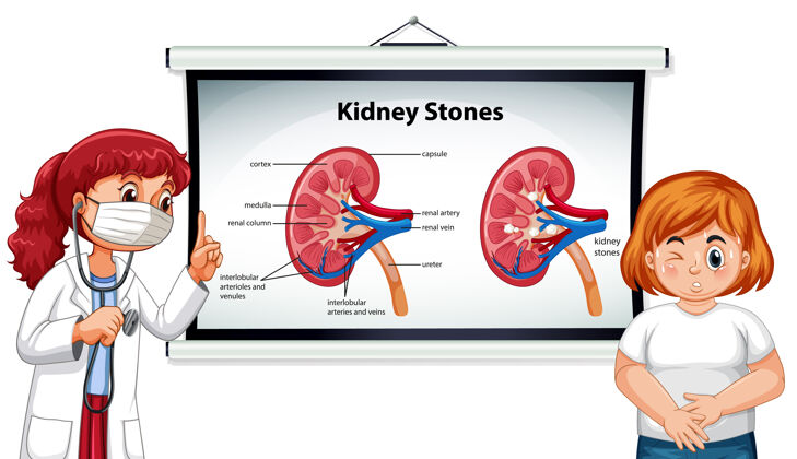 胃肾结石症状卡通式信息图与医生卡通人物卡通胃痛结石