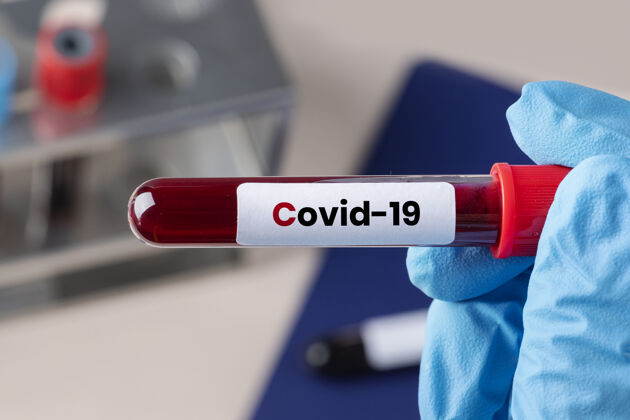 实验外科医生拿着冠状病毒血试管复制空间医院Covid19